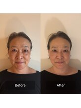 かぐや(salon)/ビフォアフ：「香り蒸」後の施術