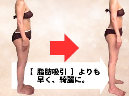 ビーエムビー(BMB)の写真