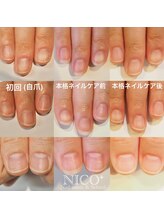 ニコプラス(NICO+)/ジェルネイルができない方向け