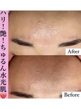 フェミニー(Feminy)/誰もが羨むちゅるん肌