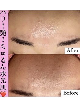 フェミニー(Feminy)/誰もが羨むちゅるん肌