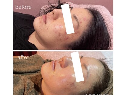 ワイズサロン(Y's salon)の写真