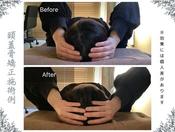 ボディ リセット アンド デザイン(Body Reset & Design)/【施術例】ビフォーアフター