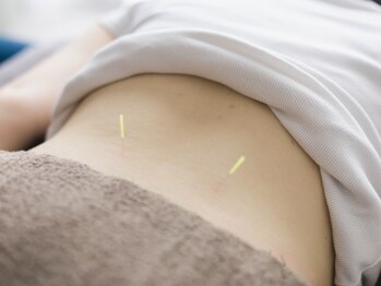 アキュベース鍼灸マッサージ院(AcuBase鍼灸マッサージ院)の写真/本八幡駅前徒歩2分！【お子様同伴可】19年の実績経験×国家資格保有の院長本人が、お客様にあった施術を。