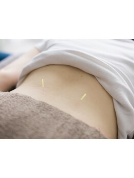 鍼灸施術を受けたい