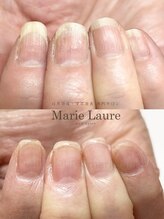 マリーロール 淀屋橋本店(Marie Laure)/自爪育成/深爪矯正/ネイルケア