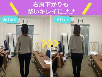 京都中丸整体カイロプラクティック/不良姿勢