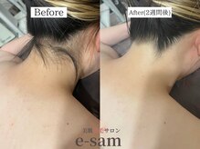 イーサム 高槻摂津富田店(e-sam)/丸ごと全身脱毛