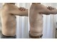 プレズィール(Plaisir)の写真/ぽっこりお腹でお悩みの方には脂肪冷却痩身☆リバウンドしにくい健康的な体づくりをしましょう♪