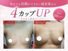 美乳組 岐阜の雰囲気(バストアップ変化が欲しい方は当店にお任せください)