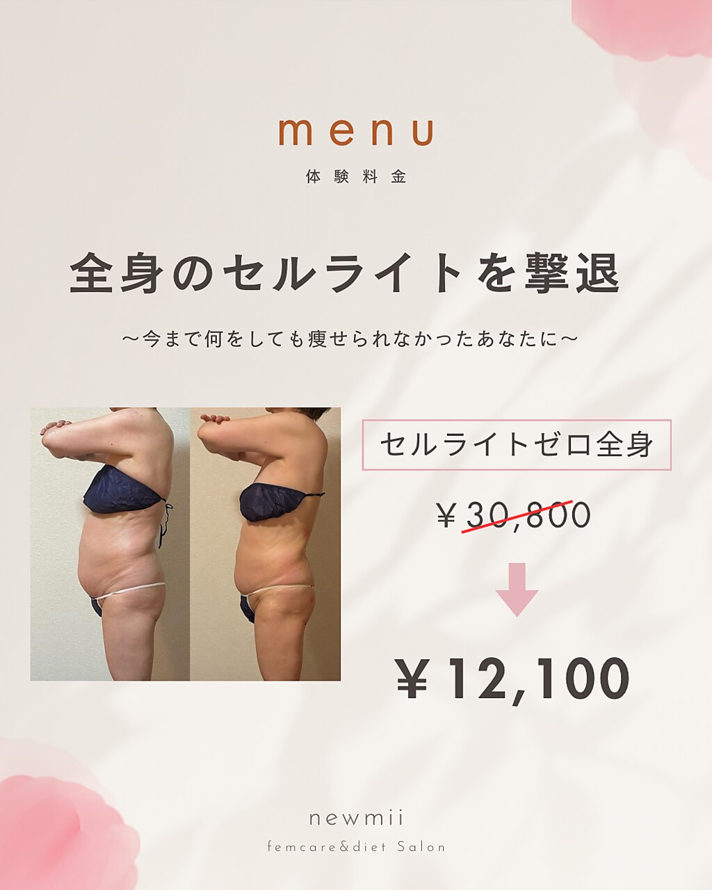 上田駅で痩身が人気のエステサロン｜ホットペッパービューティー