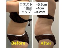 アールボディバランス/【1ヶ月モニター様】40代