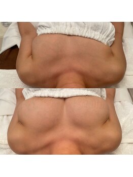 メゾン アンジュ(Maison Ange)/バスト/バストアップ美人バスト