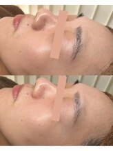 サンク(cinq)/大分初導入！！ララピール☆彡