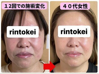 凛と慶/ビフォーアフター