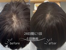 ターントウキョウスパ 表参道(turn TOKYO spa)の雰囲気（フルリクライニングチェアで心地よい夢の世界へ＊）