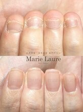 マリーロール 梅田店(Marie Laure)/深爪矯正/自爪育成/自爪風