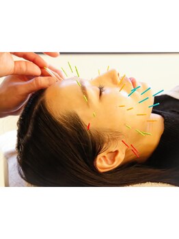 鍼灸施術を受けたい