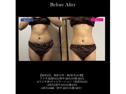 プライム(Prime)の写真