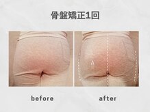 ビトリア 小顔 骨盤美容矯正サロン(BITORIA)/骨盤胸椎矯正