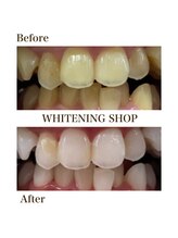 ホワイトニングショップ 四条店/ホワイトニングショップ四条店