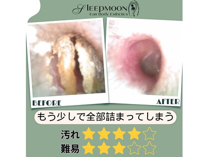 スリープムーン(Sleep MOON)の写真