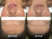 モンレーヴ(mon reve)/ハーブトリートメント