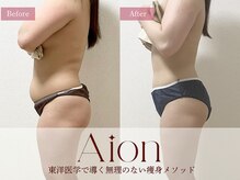 アイオン(Aion)