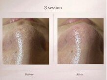 ベルミナ(Belmina)/