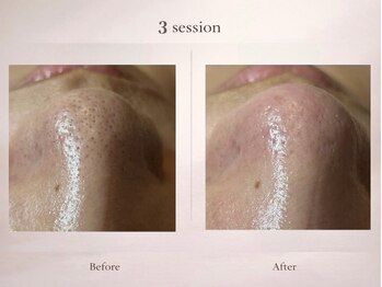 ベルミナ(Belmina)/