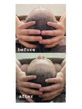 エクラ(ECLAT)/頭の凝りをほぐすと小顔に