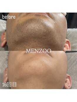 メンズー(MENZOO)/