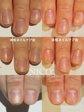 ニコプラス(NICO+)/ジェルネイルができない方向け
