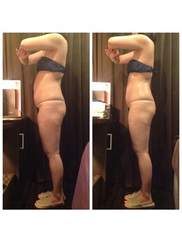 プラチナアース 守谷店(Platinum earth)/痩身ビフォーアフター