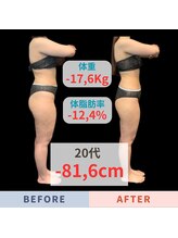 エステティック エイチアンドビー 大和店(H&B)/ビフォーアフター