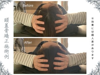 ボディ リセット アンド デザイン(Body Reset & Design)/【施術例】ビフォーアフター