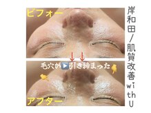 ウィズユー(with U)/開き毛穴がキュッと引き締り