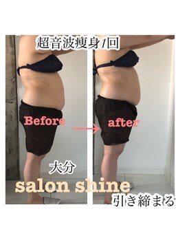 サロンシャイン(Salon Shine)/痩身マッサージ1回