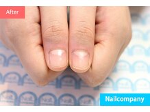 ネイルカンパニー/