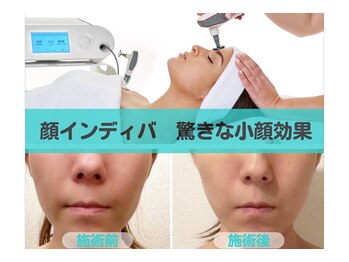 ナナ 銀座(Nana)/顔がスッキリしたい方へ