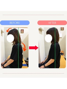 ファミ鍼灸整骨院/姿勢整体【猫背矯正】