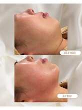 トロワ(TROIS)/業界トップ商材＆マシンで奥まで