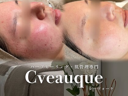 シーヴォーク(Cveauque)の写真
