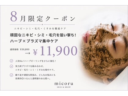 ミコル(micoru)の写真