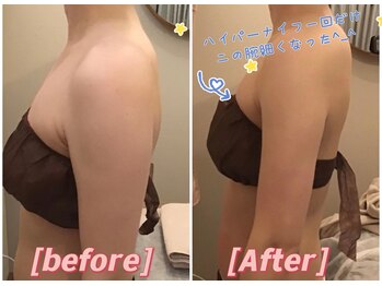 ココチ(KOKOCHI)/上半身痩せ!