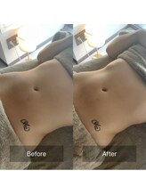 マル(MARU)/リンパマッサージで睡眠質アップ