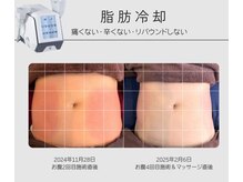 エヌスタイル(n*style)の雰囲気（大人気の脂肪冷却☆30分寝てるだけ！！）