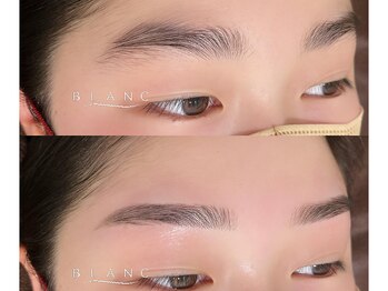 アイラッシュサロン ブラン イオンモール船橋店(Eyelash Salon Blanc)の写真/【つるんと、まあるいおでこは輪郭が綺麗に見え透明感UP！】眉wax＆おでこwaxセットがおすすめ◎