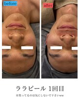 ユフラ(Juhla)/ララピール