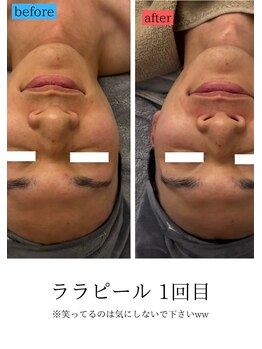 ユフラ(Juhla)/ララピール